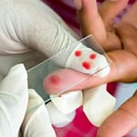 Vaccin paludisme 2018