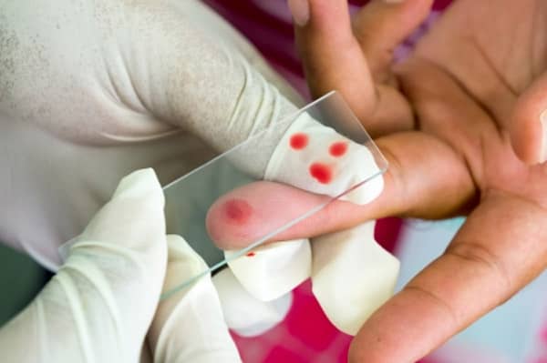 Vaccin paludisme 2018
