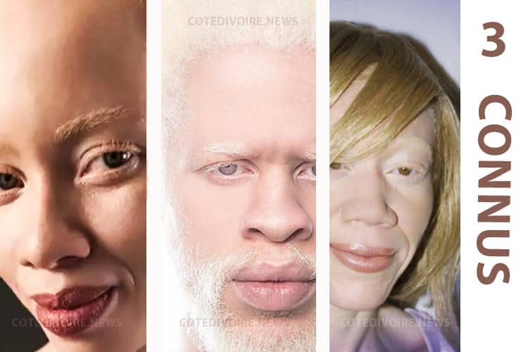 Albinos Mannequin Afrique