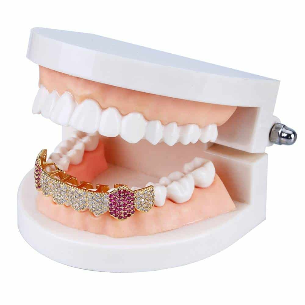 dentier en diamant prix
